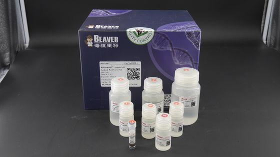 단백질 정제를 위한 2μm 30 마그네슘 / mL 1 mL 단백질 A/G 항체 정화 동작 키트