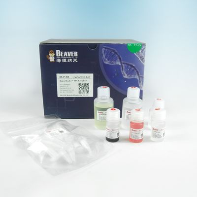 150 μm 그의 태그 단백질 정화 IDA 코발트 맥비드스는 10% 부피 비를 장비를 답니다